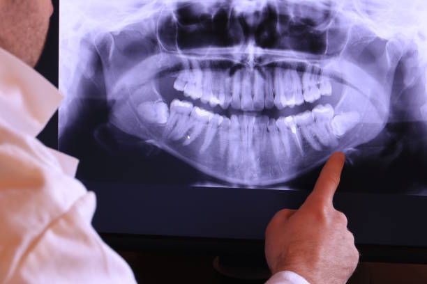 Best Emergency Treatment for Toothache in Waskom, TX