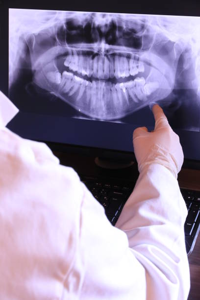 Best Emergency Wisdom Teeth Removal in Waskom, TX
