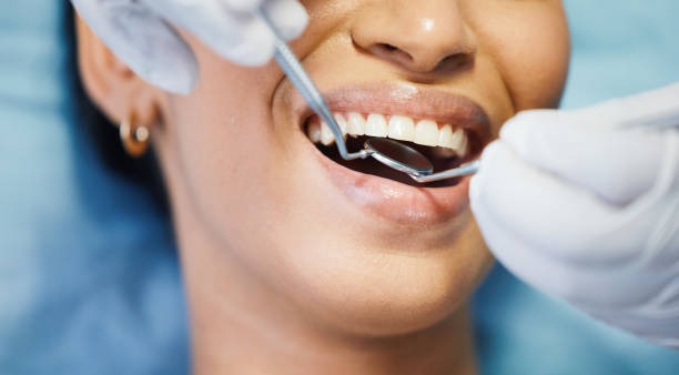 Best Emergency Broken Tooth Repair in Waskom, TX
