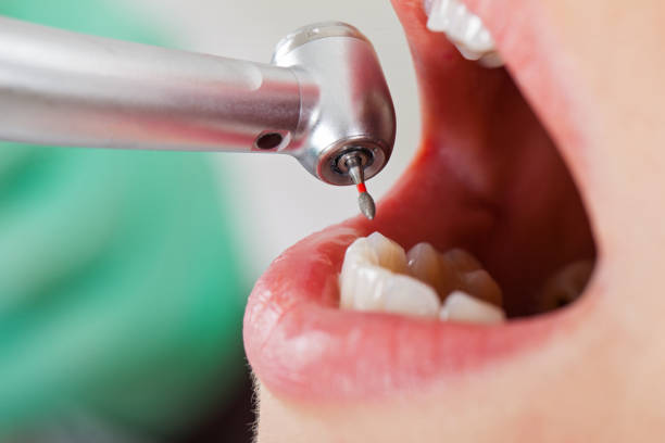Best Emergency Broken Tooth Repair in Waskom, TX